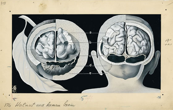 Walnut and human brain