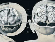 Walnut and human brain